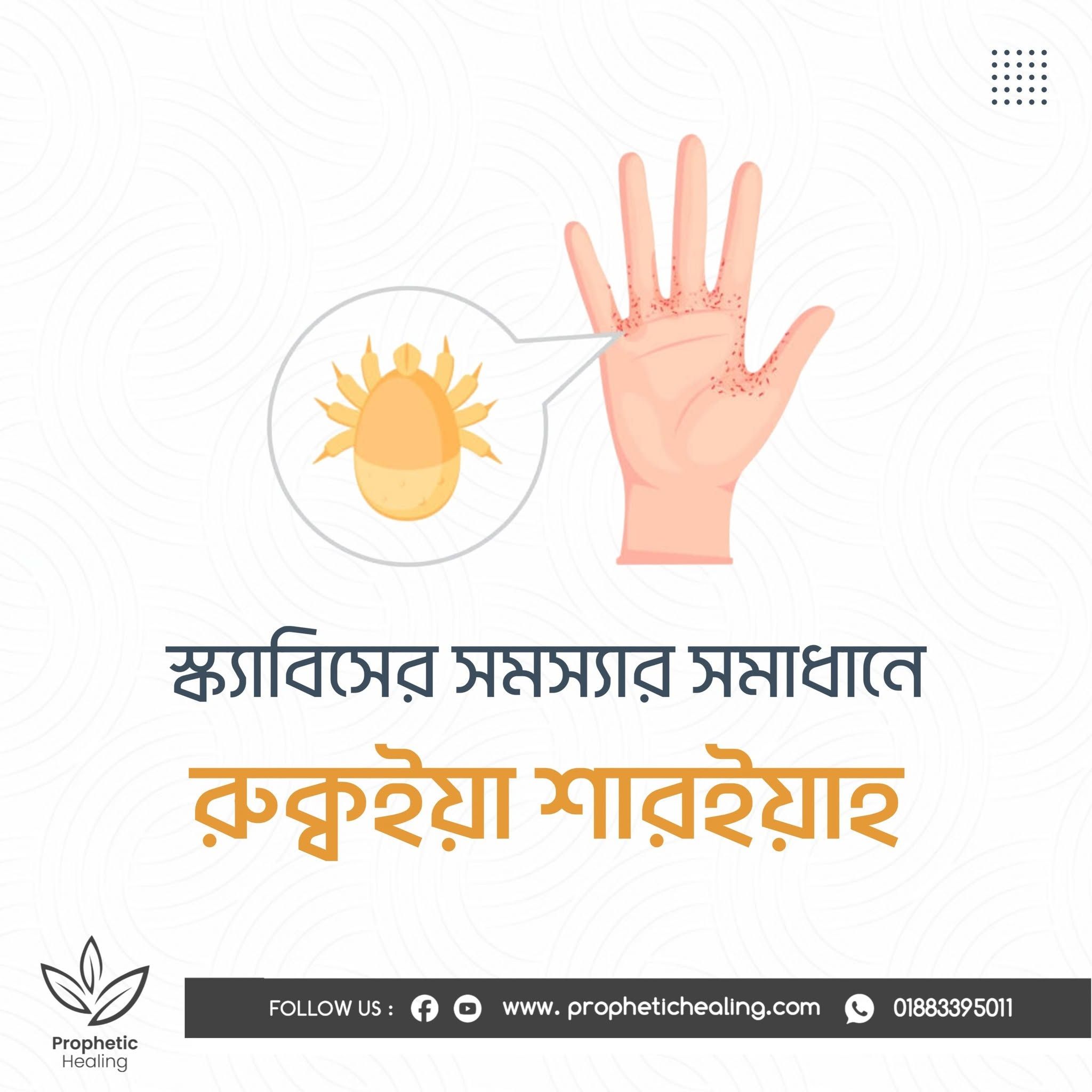 স্ক্যাবিসের জন্য রুকইয়া