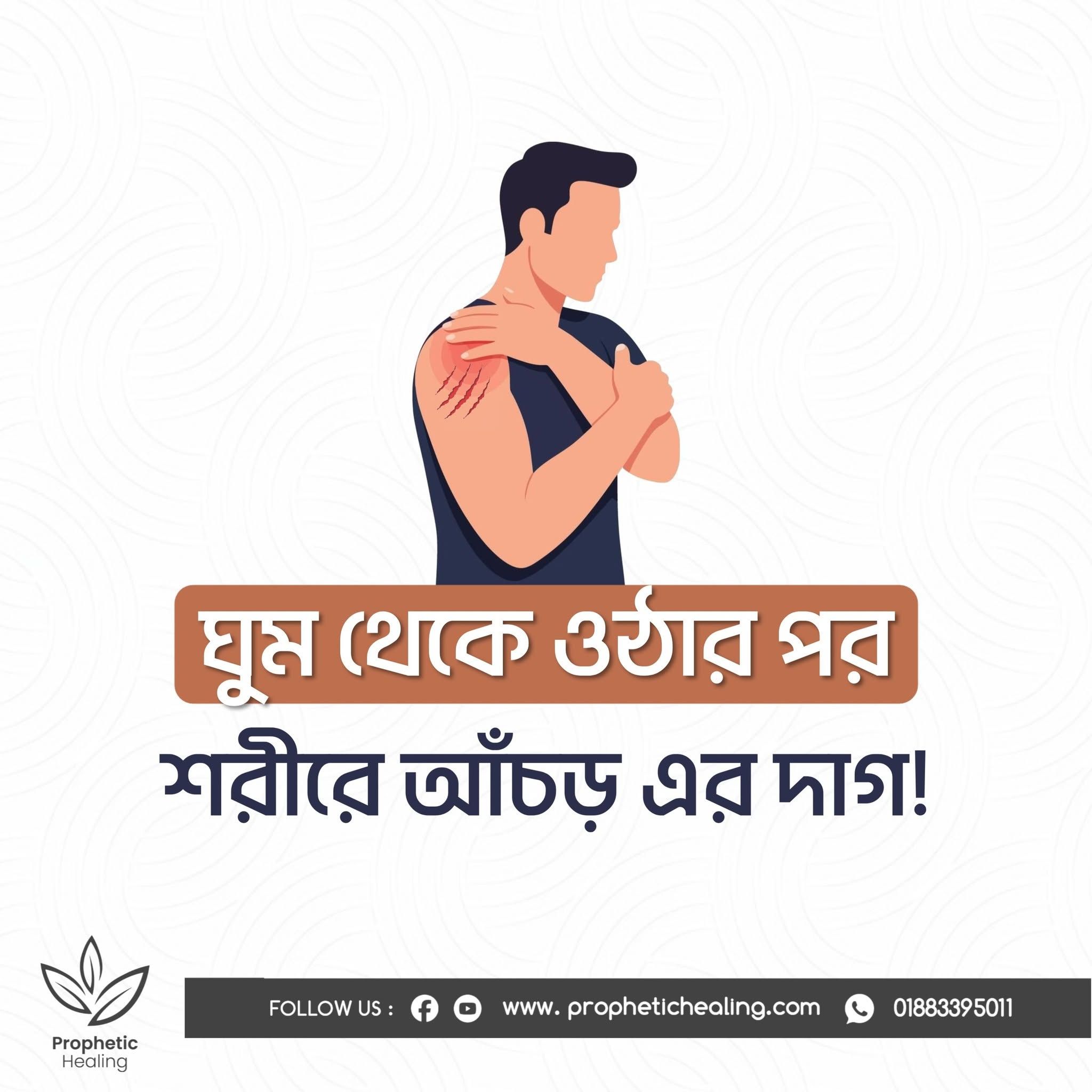 ঘুম থেকে উঠার পর শরীরে আঁচড়ের দাগ